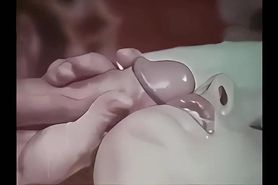 Sphincter Stretcher