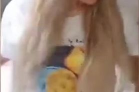 Ampute DAK on Prosthesis