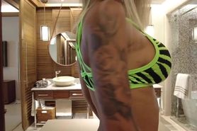 a mif anal prolapse 1420