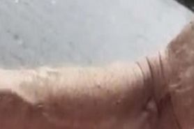 Anal1