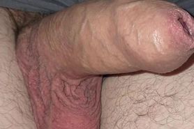 My uncircumcised penis