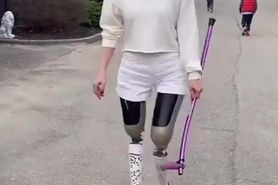 Ampute DAK on Prosthesis