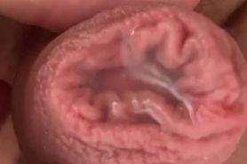 precum foreskjn play