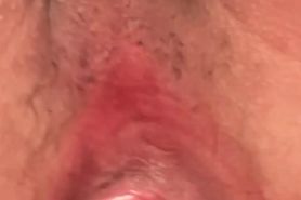 pumped up ass lips
