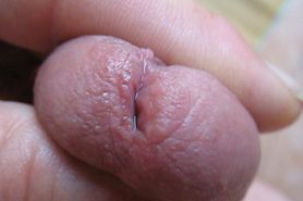 Close-up pee-hole with precum